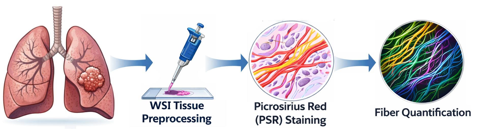 Collagenous extracellular matrix and tumor progression schematic